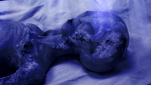 The body of an alleged extraterrestrial lying on a table